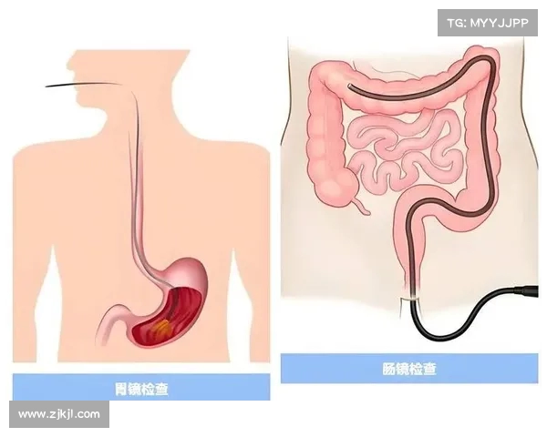 同一天做了两次肠镜:无痛麻醉与普通麻醉的对比,痛苦难以言表 同一天做了两次肠镜:无痛麻醉与普通麻醉的对比,痛苦难以言表